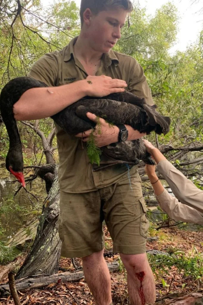 robert-irwin-knee-injury