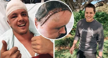 Inside Johnny Ruffo’s courageous brain cancer battle