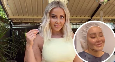 MAFS’ Cathy reveals post-surgery pain after $30K liposuction treatment
