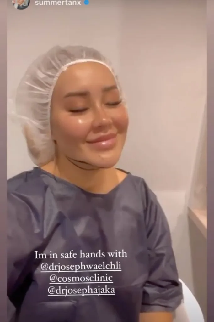 Cathy-evans-surgery