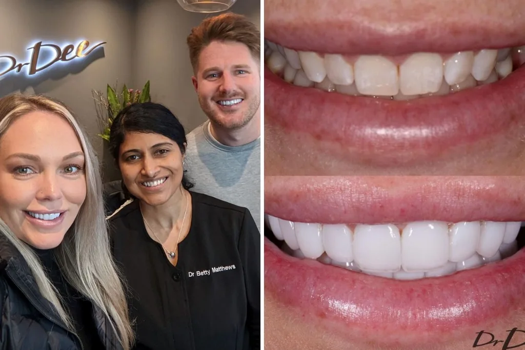 mafs-melissa-teeth