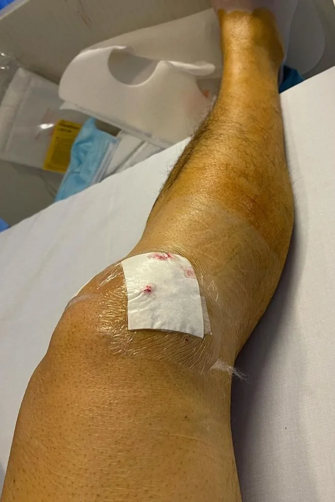 manu feildel leg injury