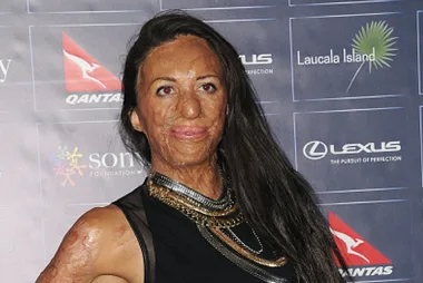 Turia Pitt’s emotional announcement