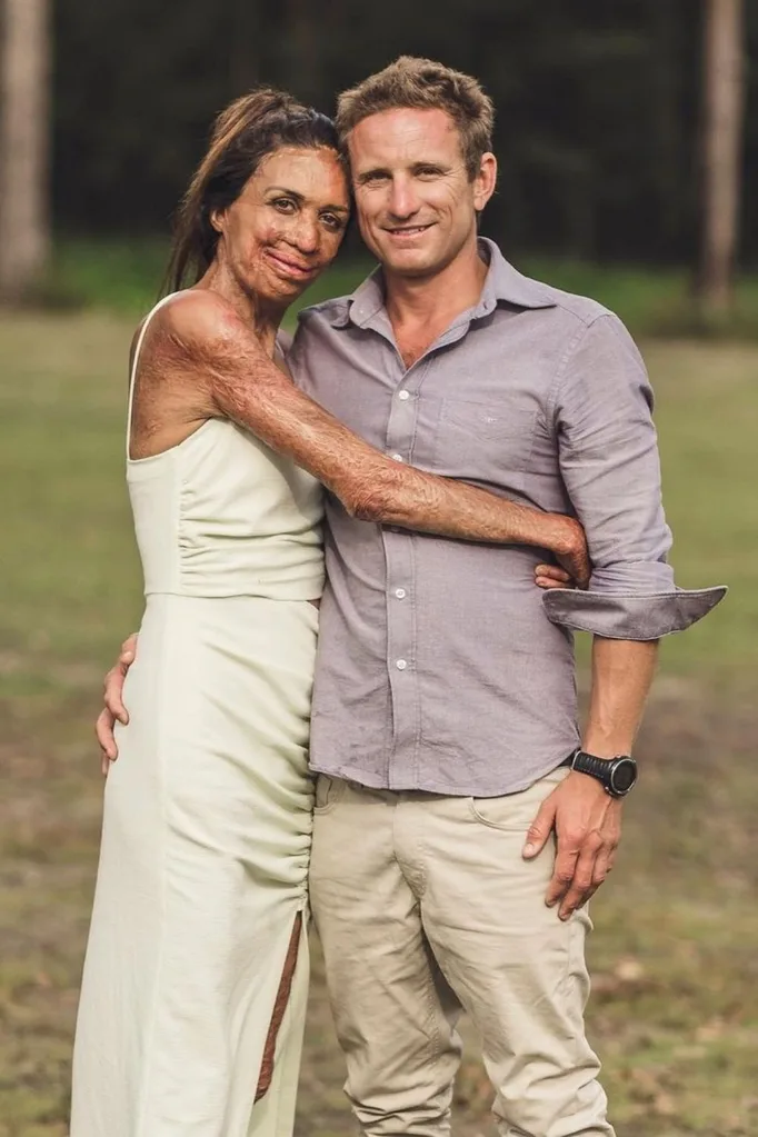 turia pitt michael hoskin