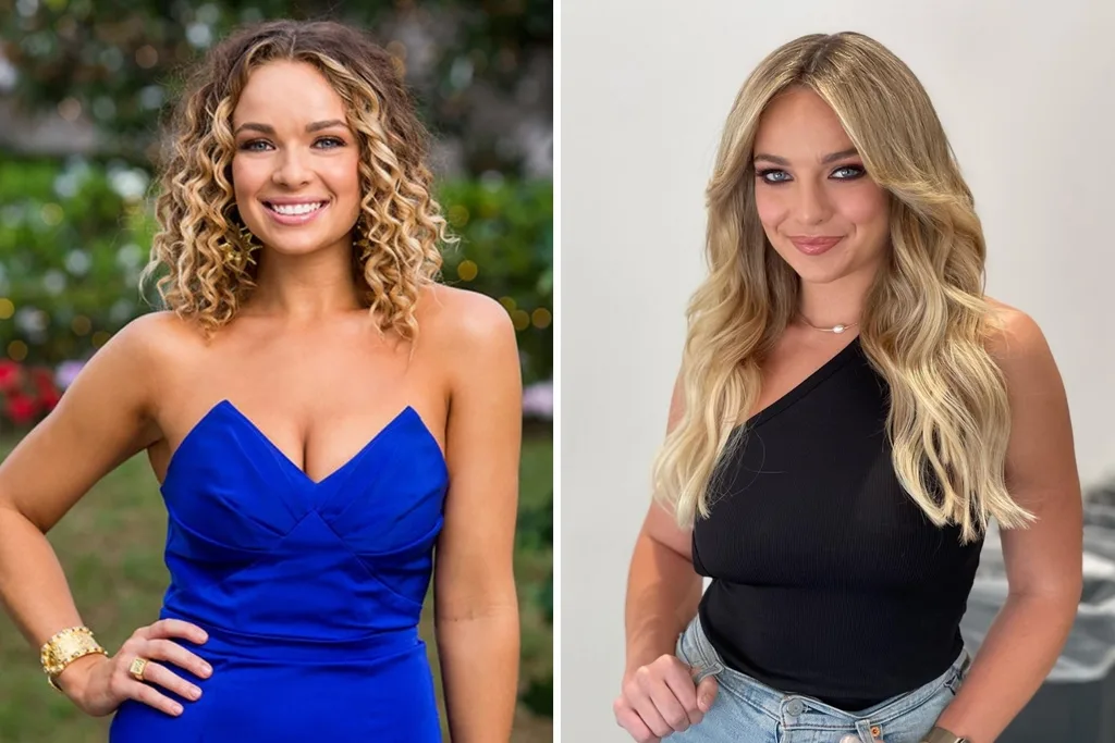 abbie chatfield bachelor before after