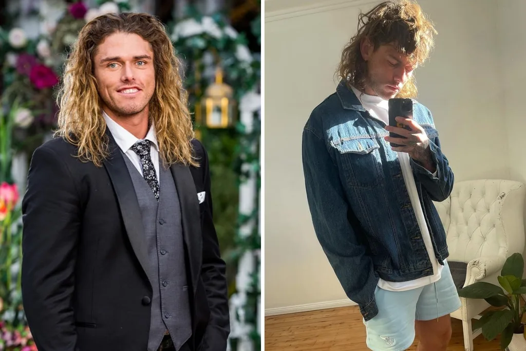 timm hanly before after