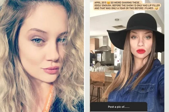 jessika-power-before-plastic-surgery