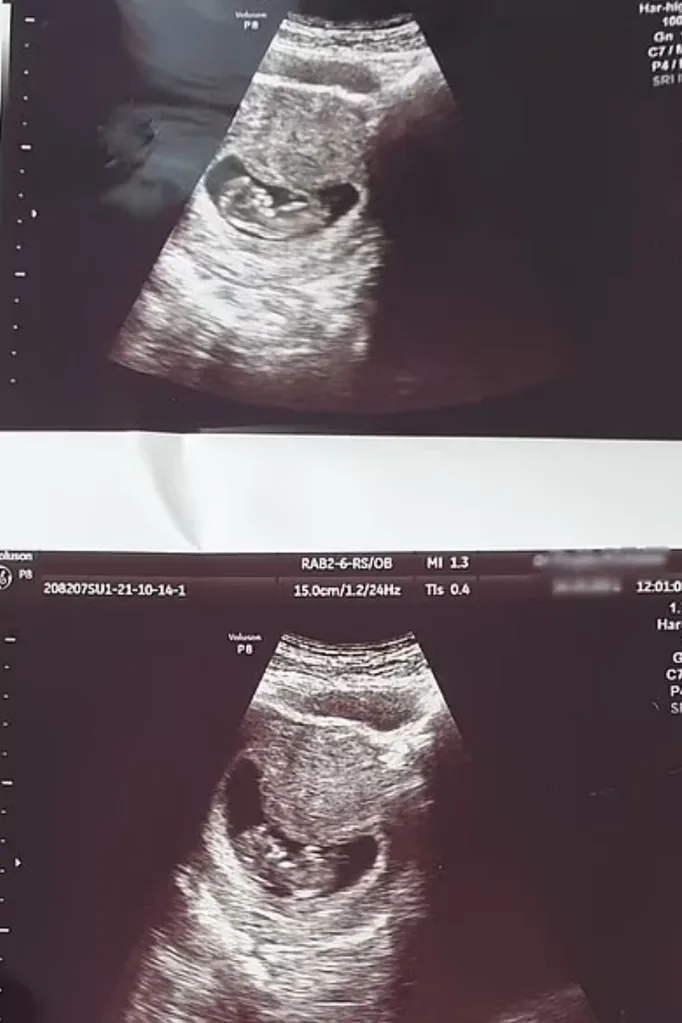 dami-pregnant