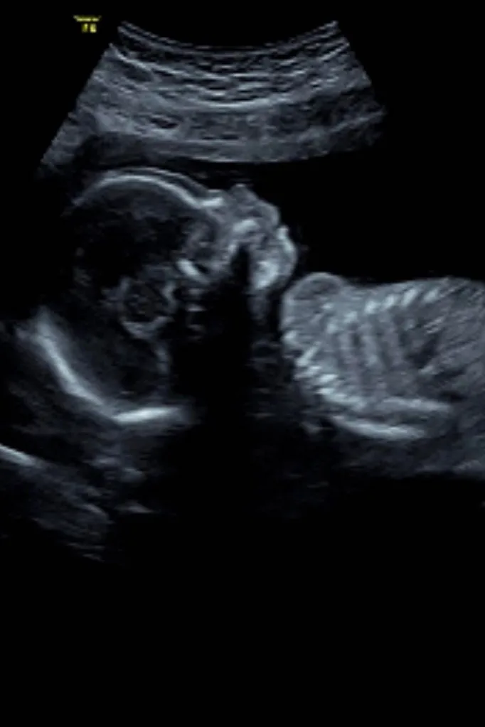 honey-badger-baby-sonogram