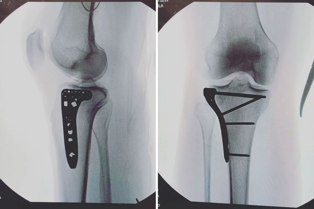 leila-mckinnon-xray