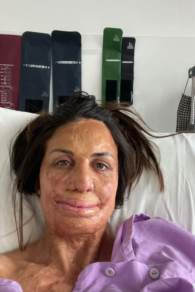 turia-pitt-hospital