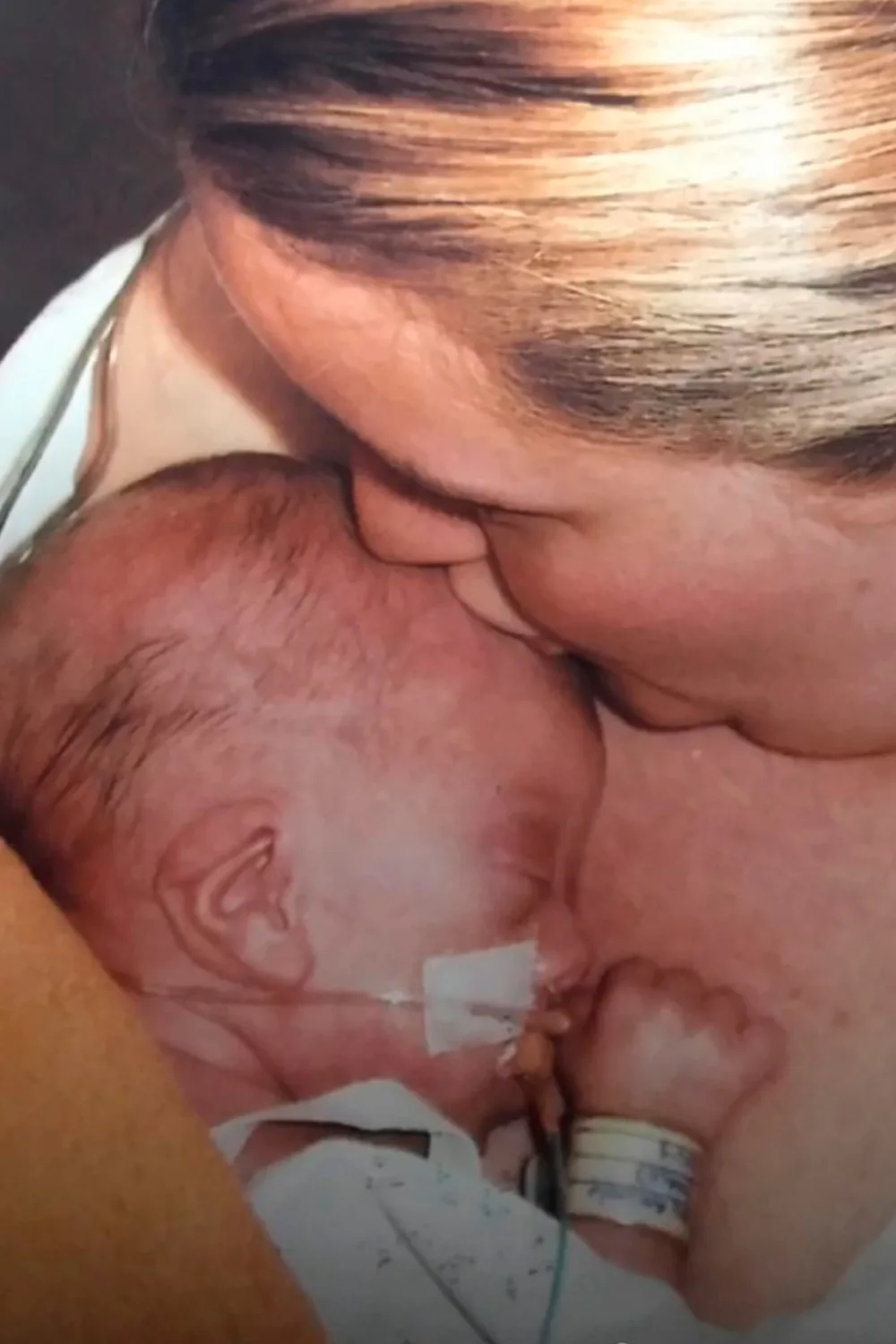 Kisses