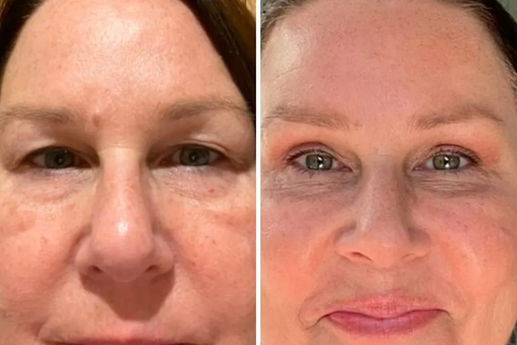 julia morris before and after