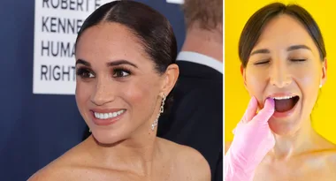 Meghan Markle’s go-to facial involves inner-mouth massage