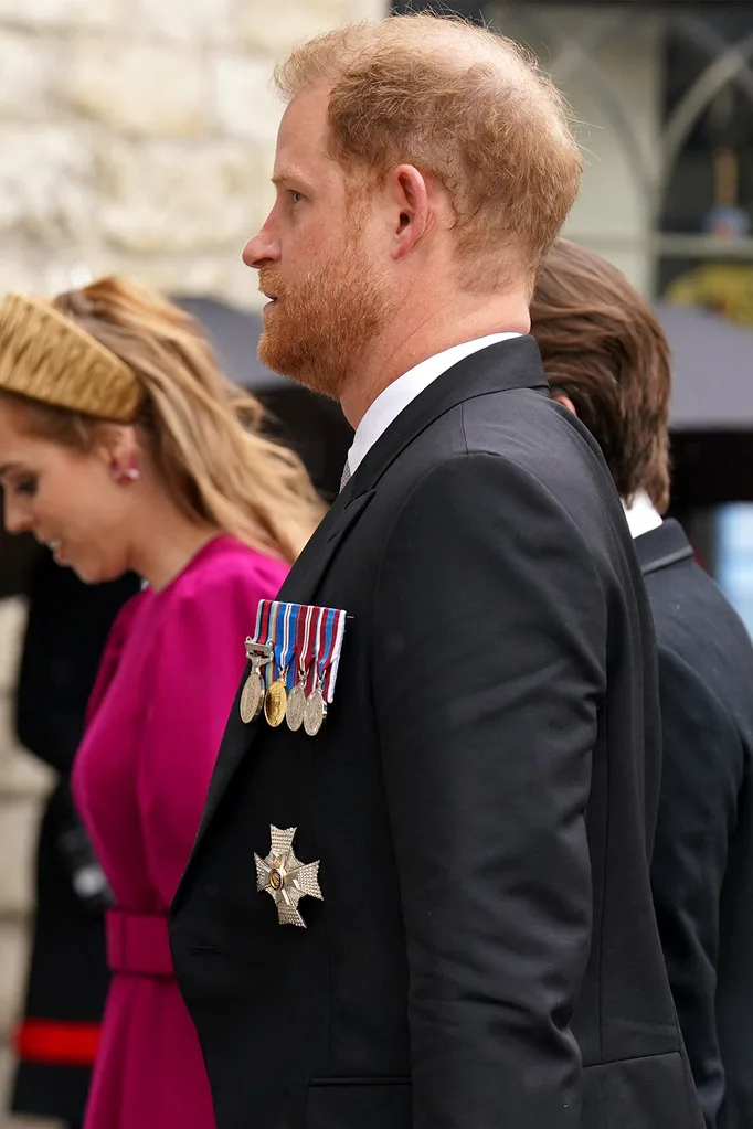 harry