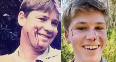 Robert Irwin left bruised and bloodied after alarming animal encounter