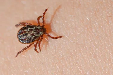 The right way to remove a tick