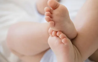 Doctors asked mum if she really wanted to see her baby after he was born with Tessier cleft