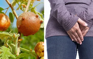 Dr warns: Why you shouldn’t put wasps nests in your vagina