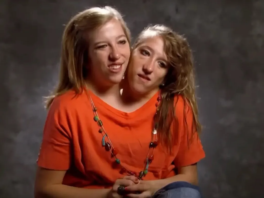 Young Abby and Brittany Hensel