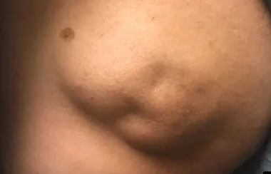 Dr Pimple Popper’s latest video is one of the “most surprising” you’ve ever seen