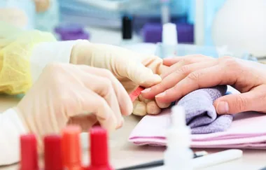 Is this the worst manicure you’ve ever seen?