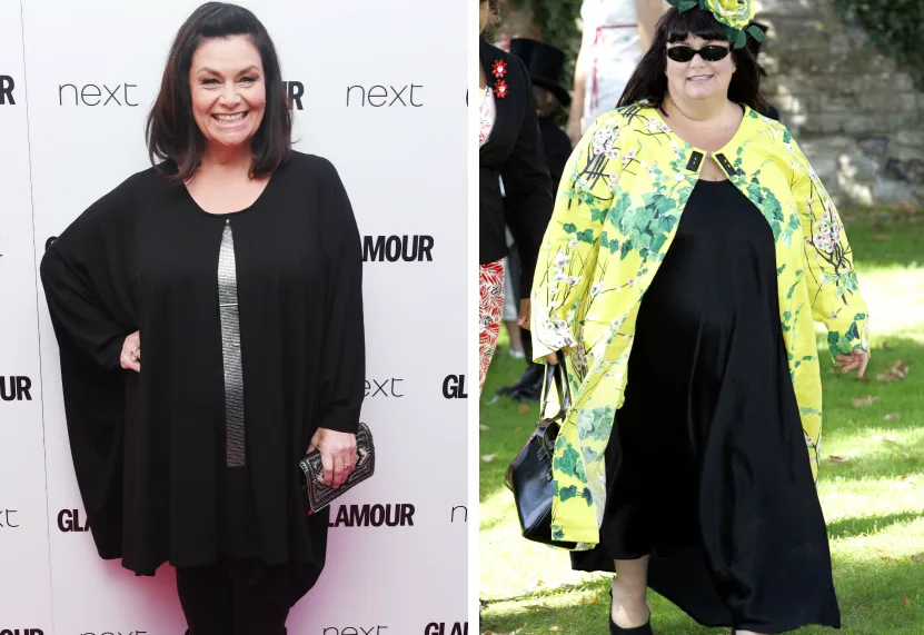 Dawn French weight loss transformation