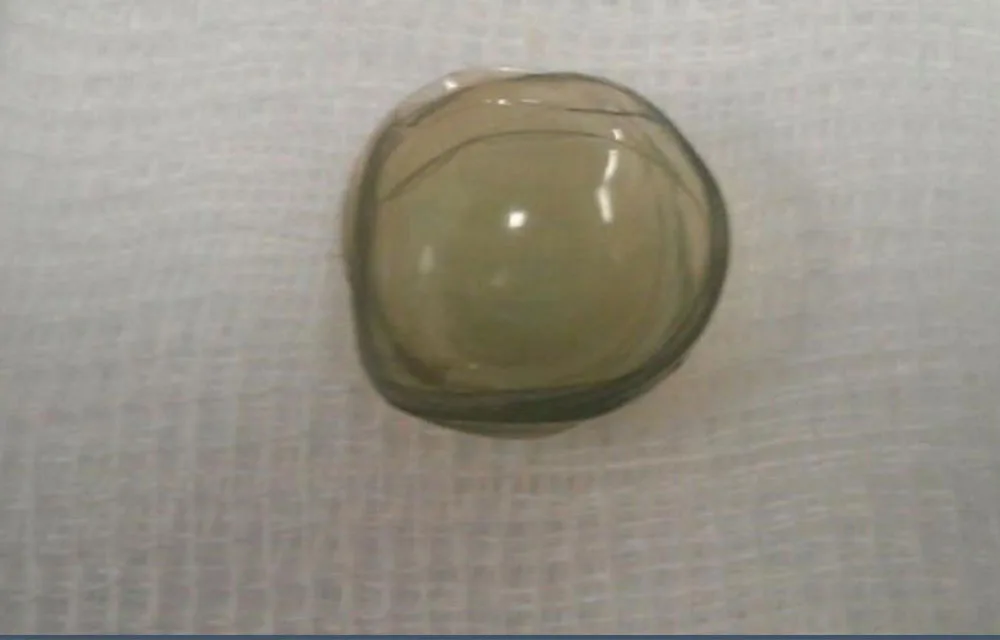 Contact lenses