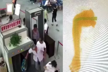 The shocking reason this man had two human arms in his luggage