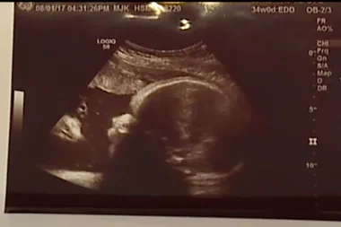 Stunned parents spot spooky presence watching over bub in womb