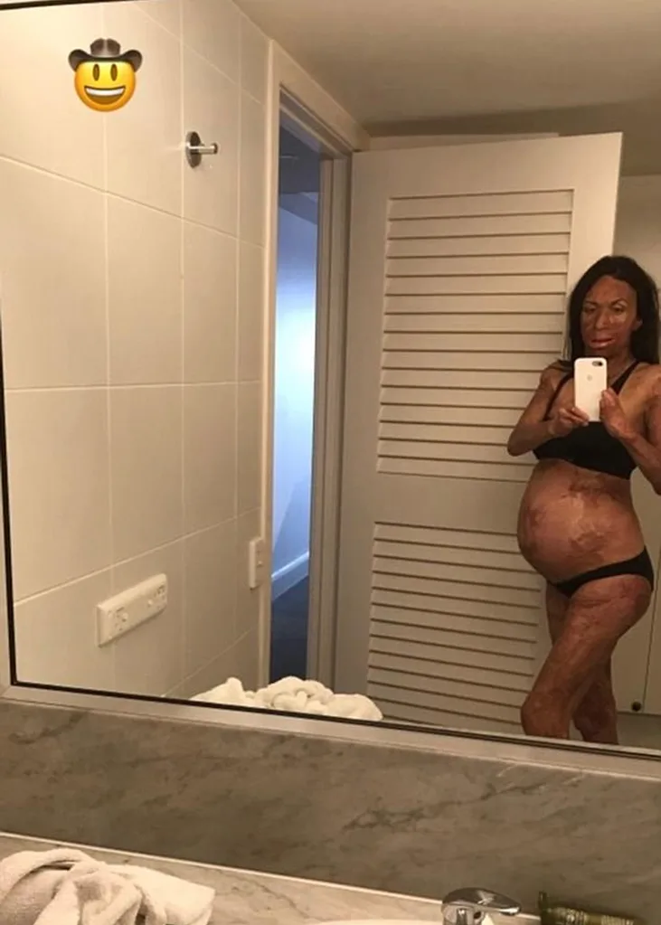 Turia Pitt