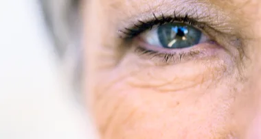 What you need to know about eye ‘floaters’
