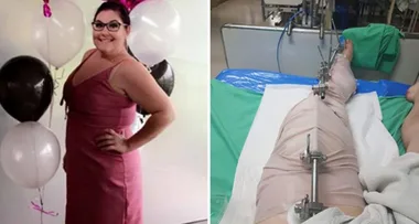 Aussie woman may lose leg after Thailand holiday nightmare
