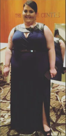 Anastasia weighed 170 kilos before her transformation