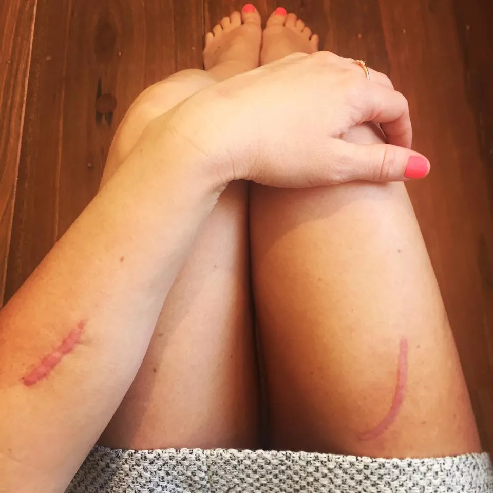 A year after the attack she shares an emotional post on Facebook