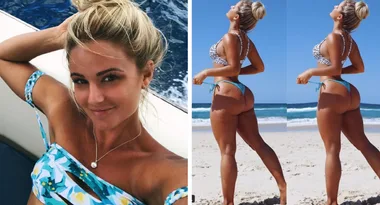 ‘Got rid of my scars and cellulite’: Aussie bikini model’s candid comparison pics