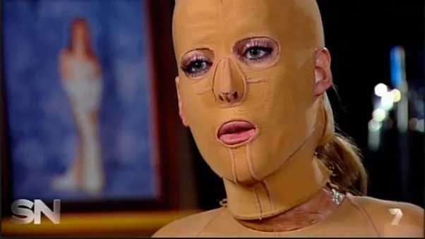 Dana was famously pictured in a mask after her ordeal