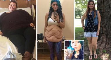 173 kilo woman credits CHEESE STICKS for staggering weightloss