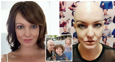 ‘I haven’t had hair for twelve years’