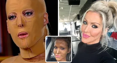 Burns survivor Dana Vulin shares her skincare secrets