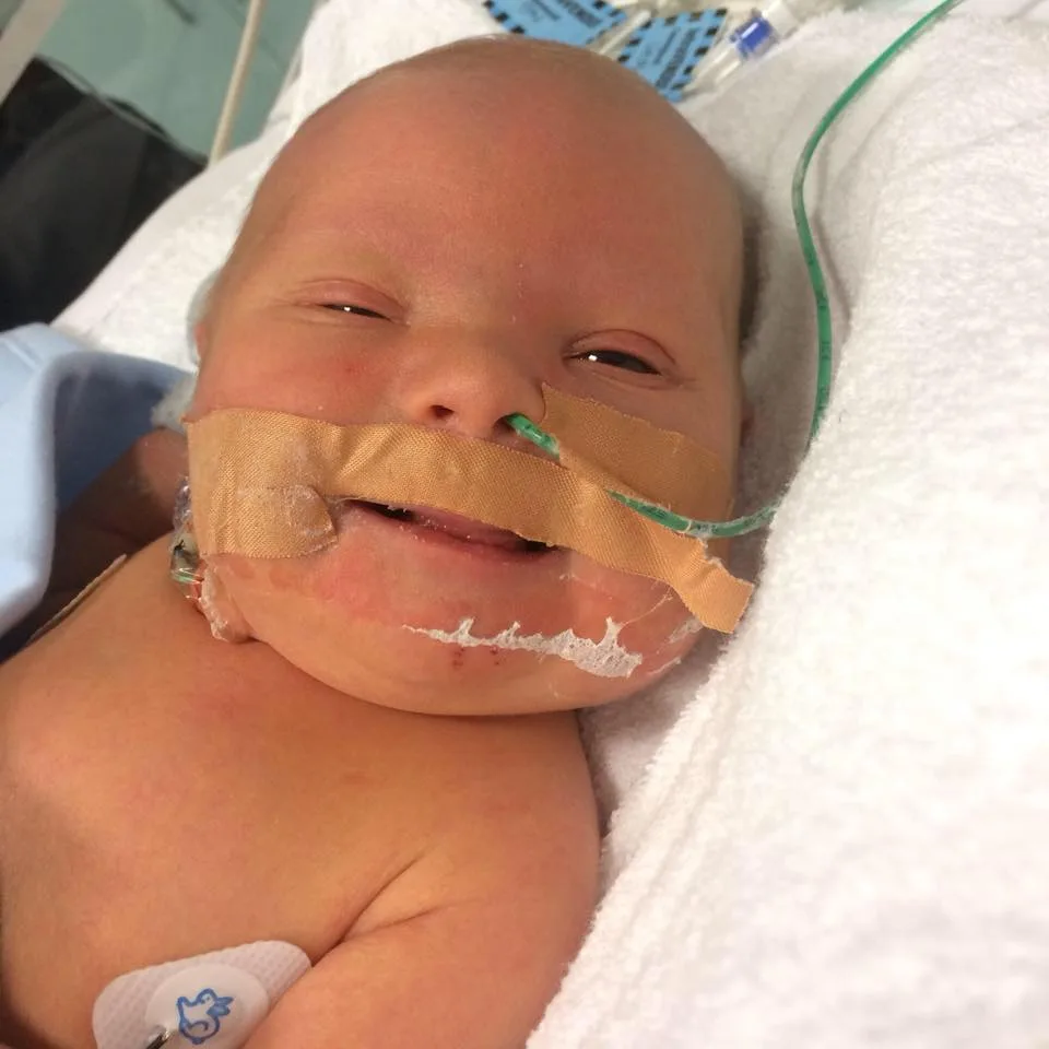 Teen mum Brodie's baby has Down syndrome. She shared her birth story with New Idea