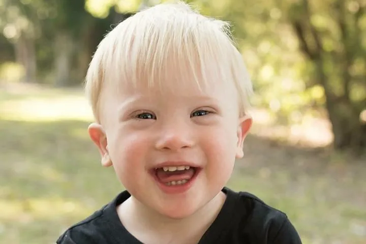 down syndrome
