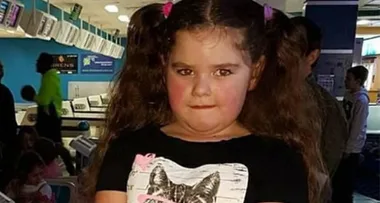 Young girl hits puberty at 2-years-old
