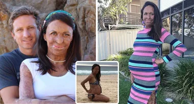 ‘Pretty scary’: Pregnant Turia Pitt is about to pop!