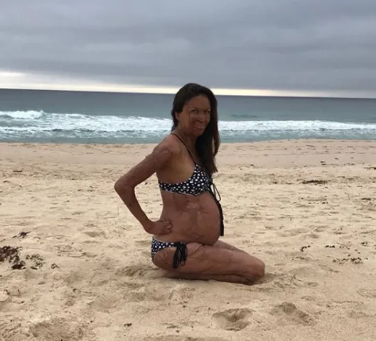 Turia Pitt has announced the birth of her baby boy