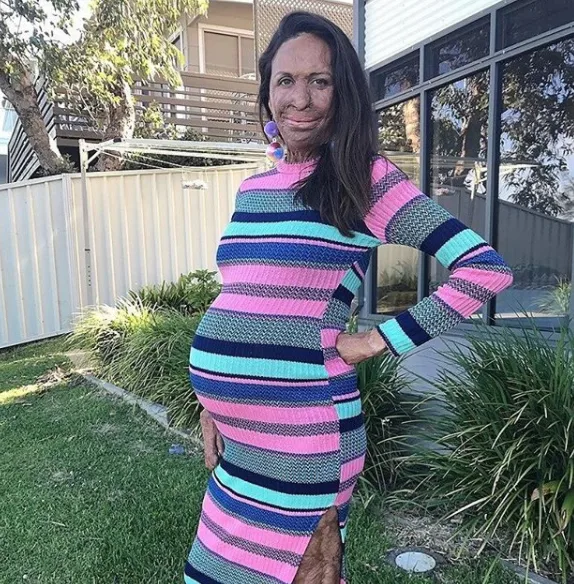 Turia Pitt has announced the birth of her baby boy