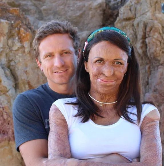 Turia Pitt has announced the birth of her baby boy