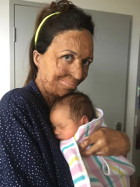 Turia Pitt has revealed she is struggling with breastfeeding