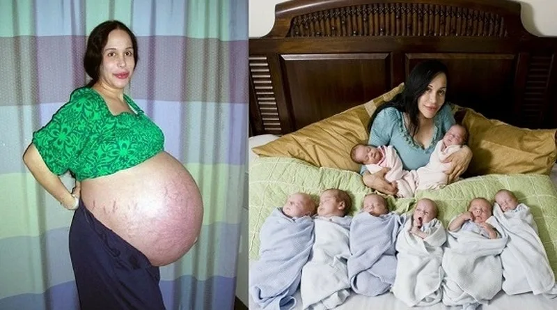octomom