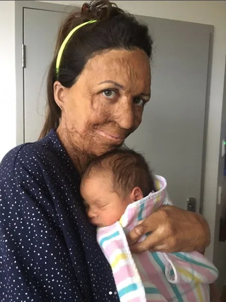 Turia Pitt shared some new pictures of her baby boy